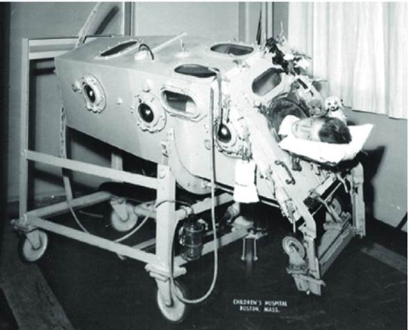 Pulmón de acero tipo drinker machine